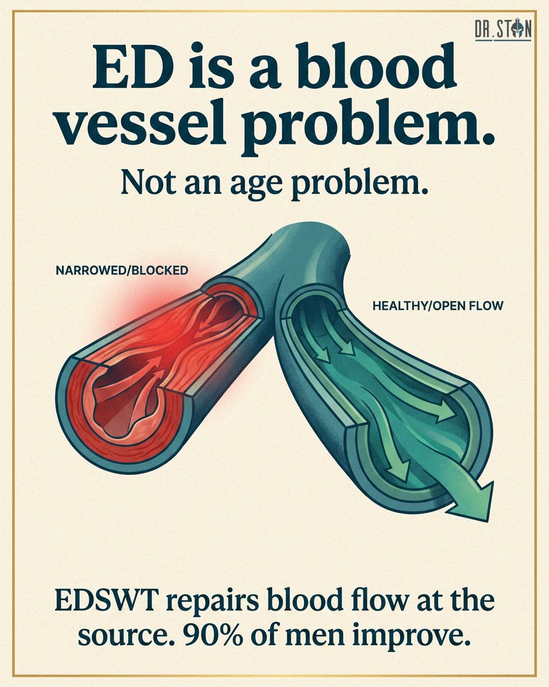 Not age. Blood vessels.